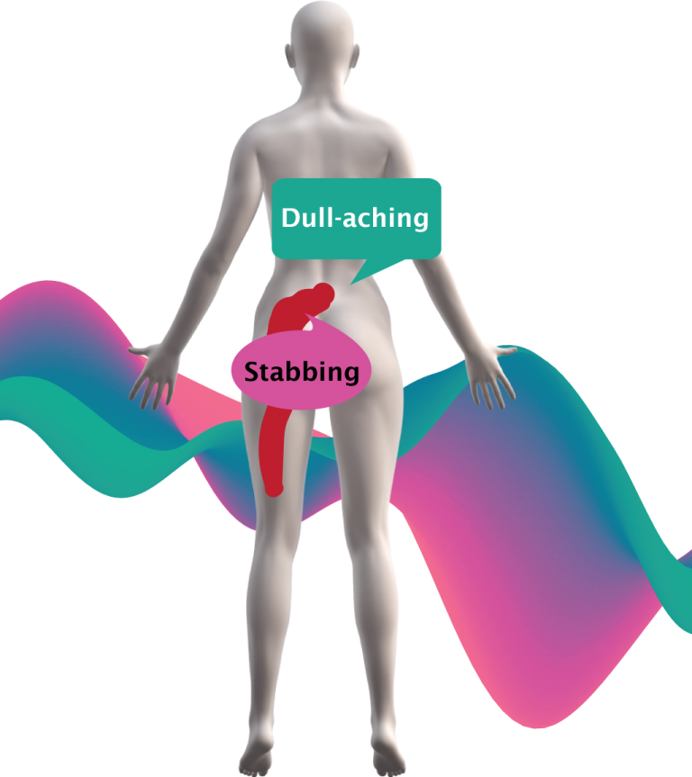 Female reporting of low back pain, radicular pain, on a body chart