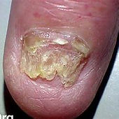 The Peebles and Penicuik Podiatrist Clinics.png
