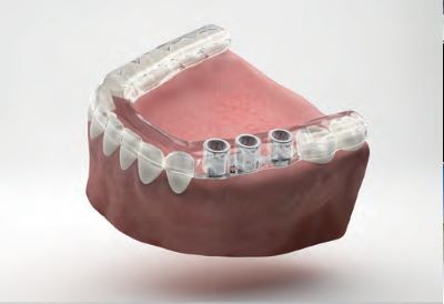 posa della guida rid