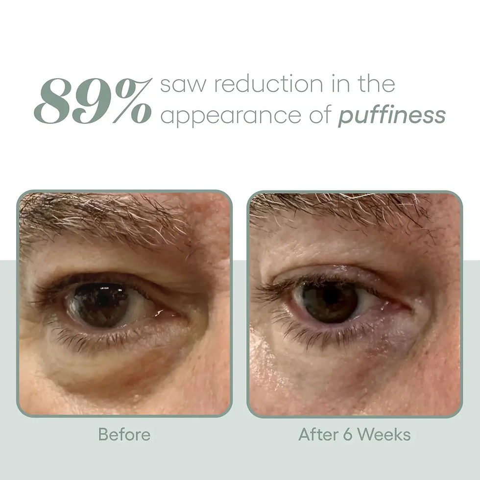 Thumbnail: (Plated) Skin Science - EYE Serum