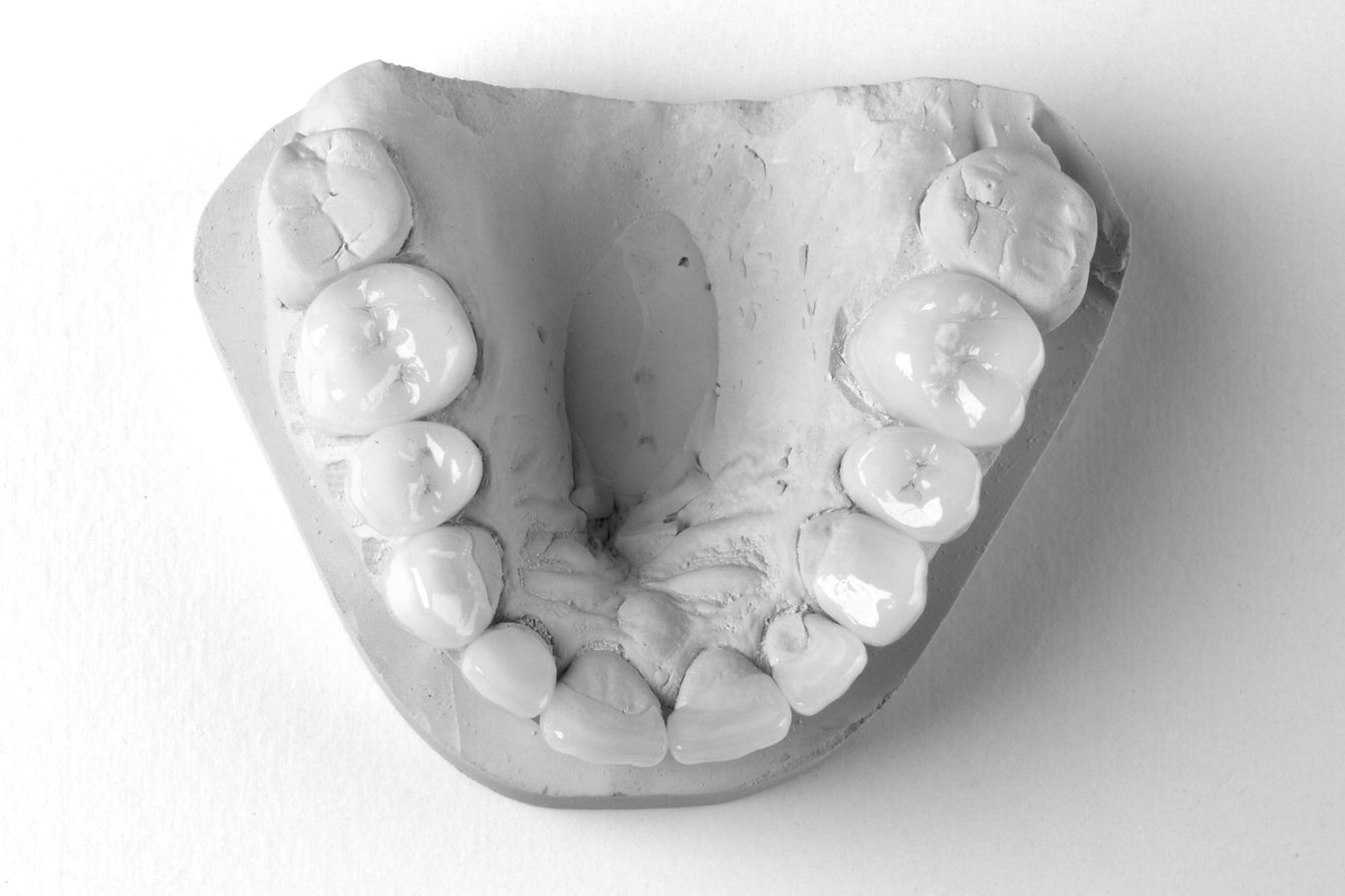 43-dental-crowns_edited.jpg