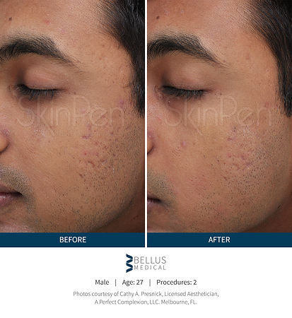 Before and After Image (1).jpg