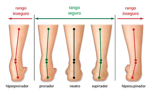 estudio-pisada-pronador-supinador-2.jpg