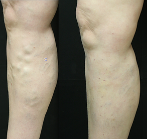 Ayelet-3-weeks-apart.png