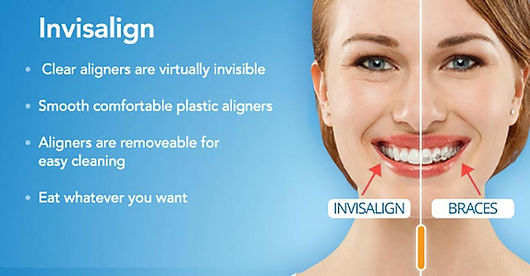 holland-mi-invisalign-dentists.jpg