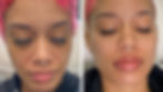 Before and after DiamondGlow Facial