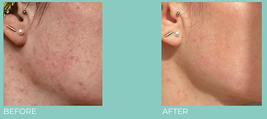 Screenshot 2026-03-22 at 5.03.22 PM.png