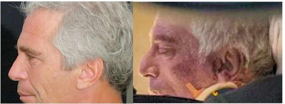 Compare Jeffrey Epstein (L) with the dead guy on the gurney (R)