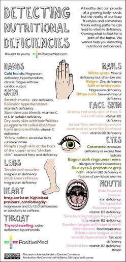Detecting Nutritional Deficiencies