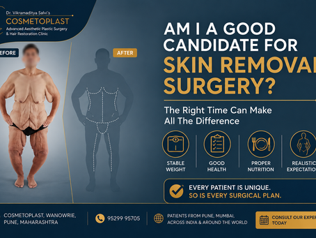 Dr. Vikramaditya Salvi at Cosmetoplast, Pune, discusses about what you must know before considering skin removal surgery after massive weightloss 