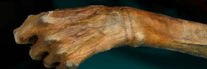 mano de la momia Ötzi mostrado el tatuaje de dos lineas paralelas alrededor de la muñeca