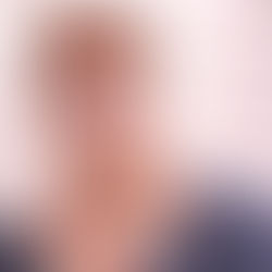 SHIFTING PRIMARY FIELD