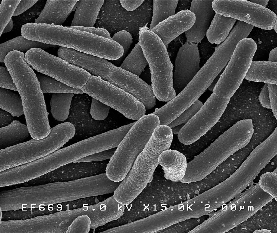 proteobacteria bakterisi görseli