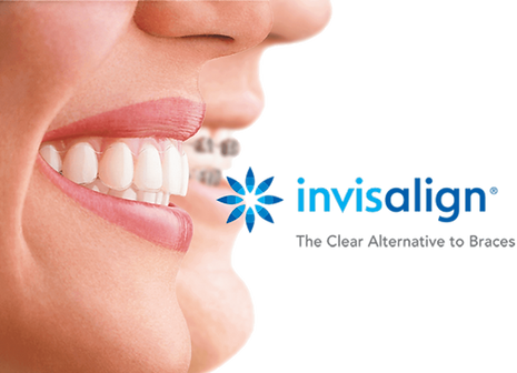 invisalign-header_edited_edited.png