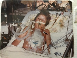 Transposition of great vessels, ASD, pulmonary atresia, jason crutchley, congenital heart disease, heart defects