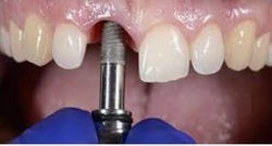 WhatsApp Image 2022-08-04 at 3.36.59 PM