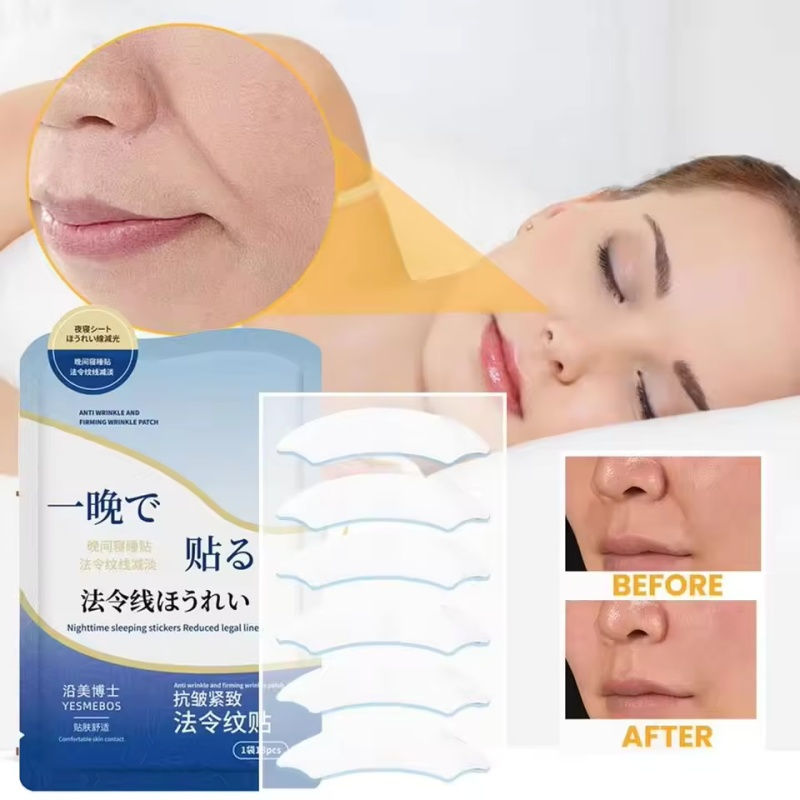 Thumbnail: Nasolabial Folds Patch Collagen