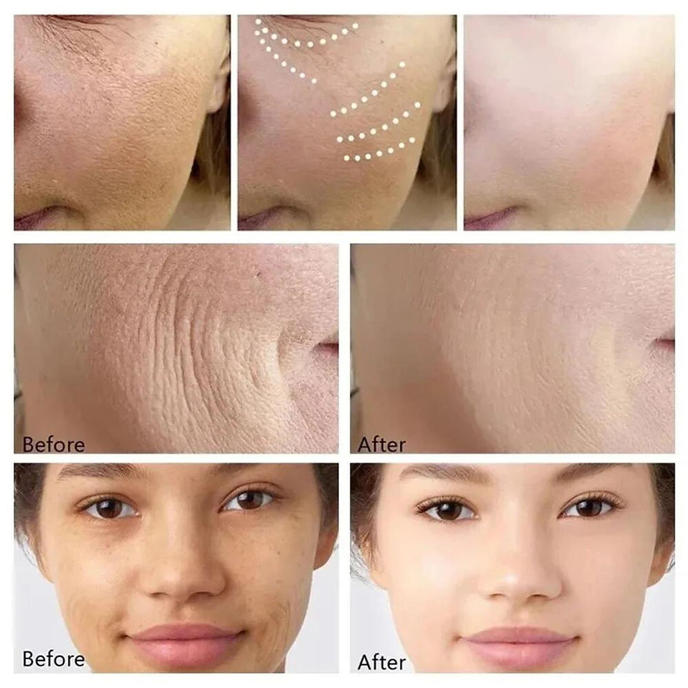 Thumbnail: Retinol Wrinkle Remover Instant Firming Lifting Anti-Aging Serum