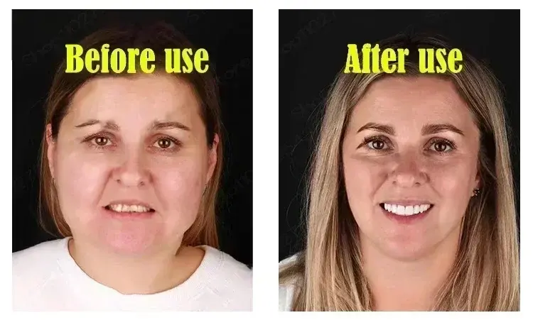 Thumbnail: NewV-Shape Face Cream Remove Double Chins Firming Lifting Up V Cheek Fat Burning