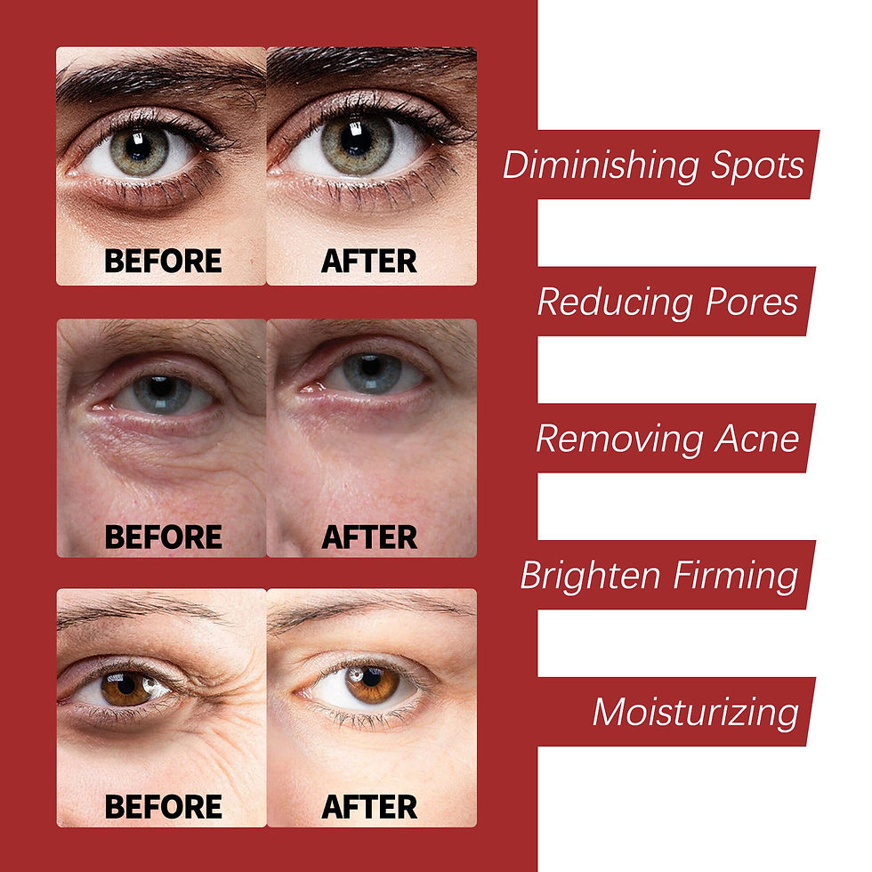 Thumbnail: Retinol Wrinkle Remover Instant Firming Lifting Anti-Aging Serum