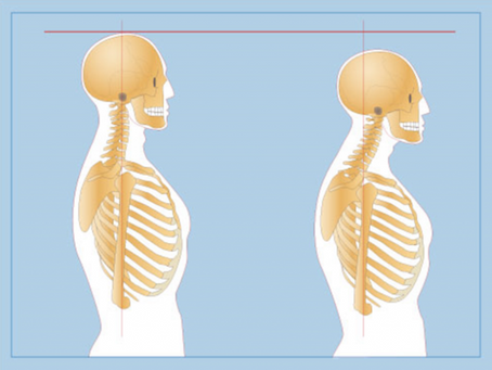 Stand Up Straight to Relieve Stress