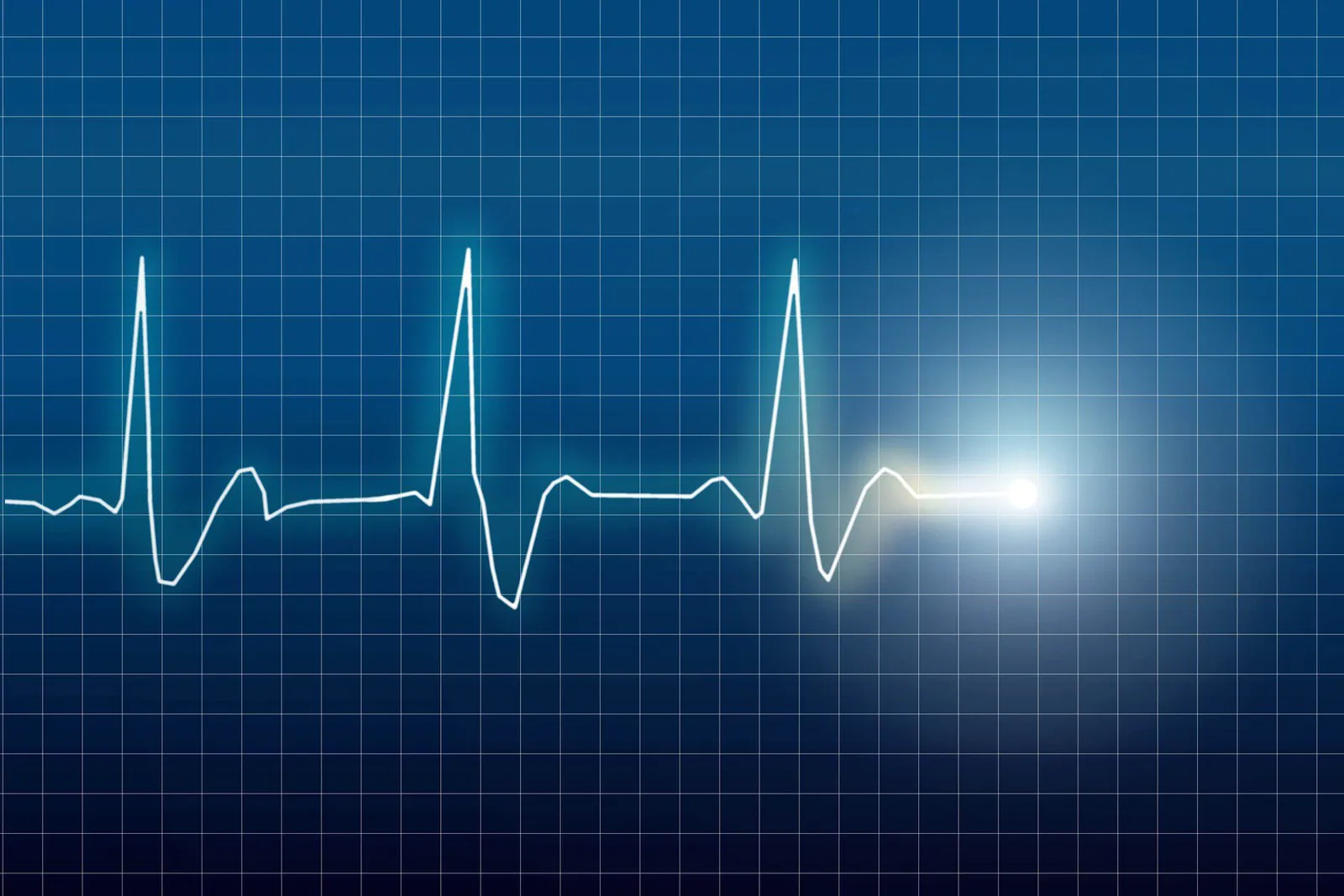 heartbeat-monitor.webp