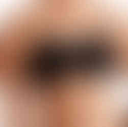 Amoena mastectomy bra Brisbane Tracey G