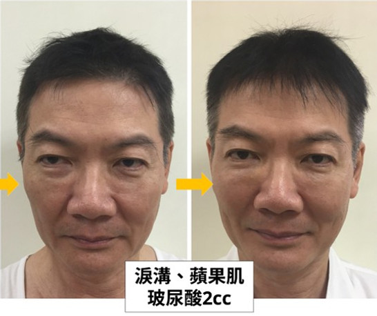 陳建業診所_鼻整形專家