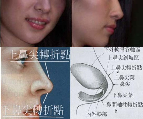 陳建業診所_鼻整形專家