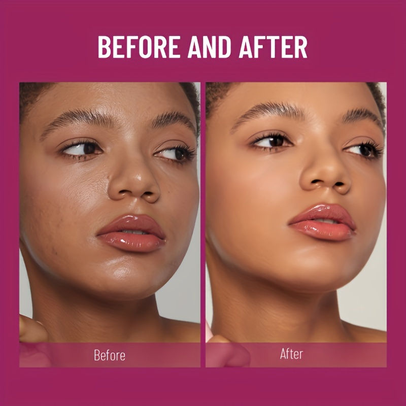 Thumbnail: New Sponge Head Concealer for Dark Circles Freckles Acne Pigmentation and Blemis