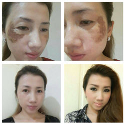 อาการแพ้เครื่องสำอาง