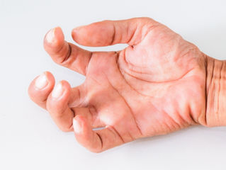 Brain stimulation protocol reduces spasticity in spinal cord injury patients