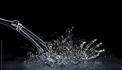 FRACTURA OSTEOPOROSIS