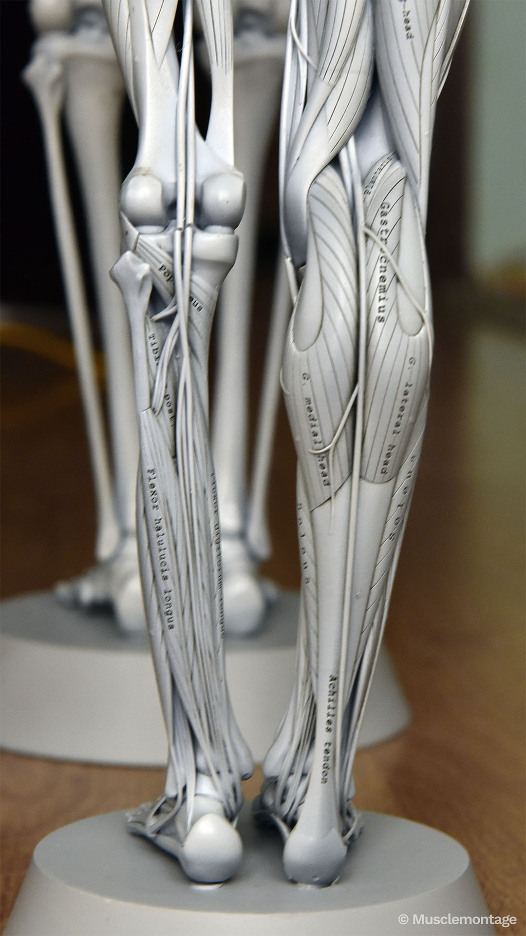 Anatomy model - posterior leg, Gastrocnemius, Soleus, Achilles Tendon, Popliteus, Flexor Hallucis Longus, deep posterior compartment