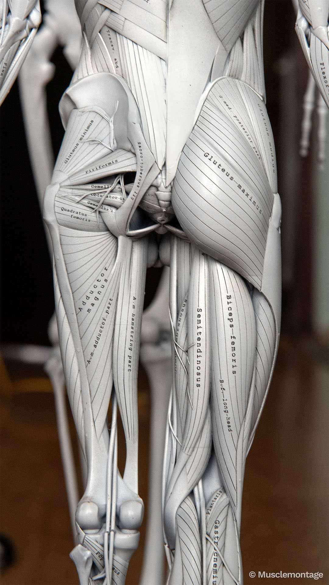 Anatomy model showing posterior thigh and gluteal region, Biceps Femoris, Semitendinosus, Gluteus Maximus and deep hip rotators