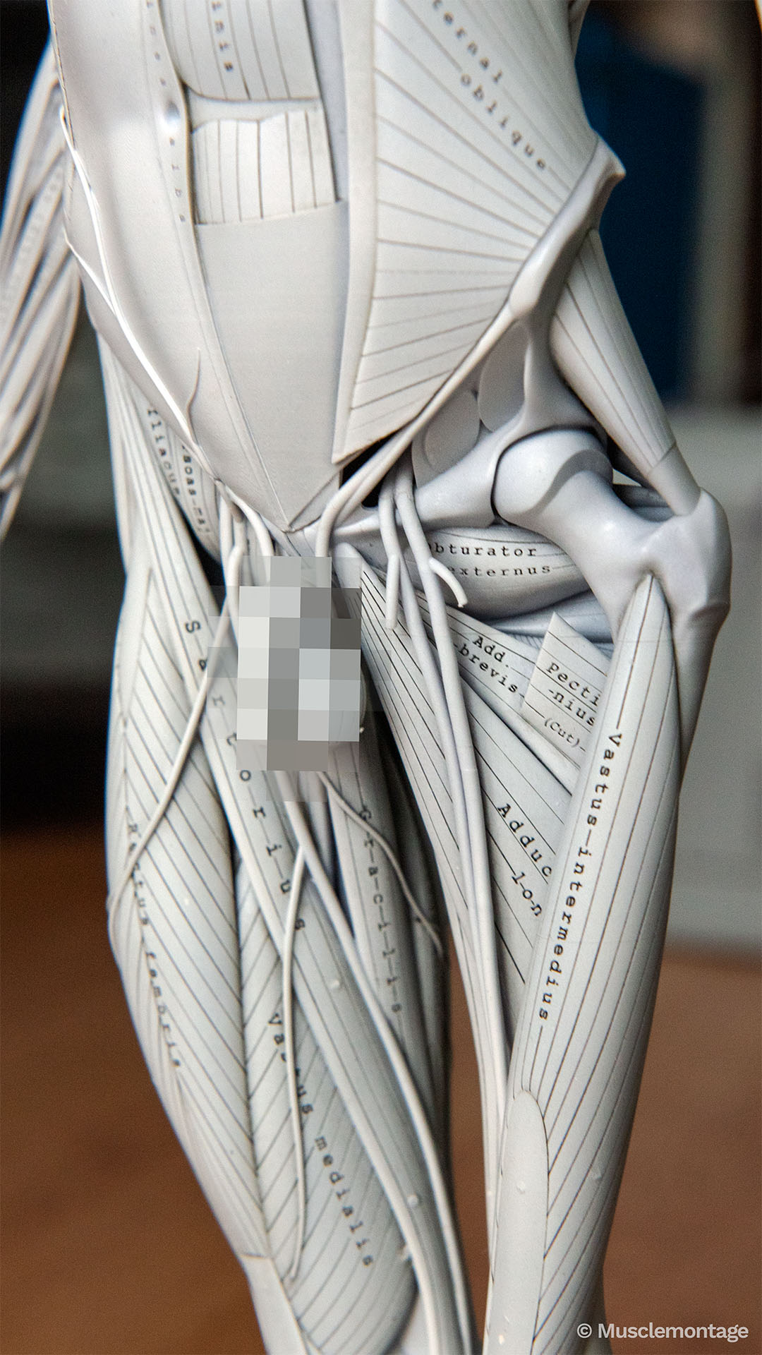 3D-printed anatomy model - anterior thigh and femoral triangle, Quadriceps, Adductors, Obturator Externus, femoral nerve, artery and vein