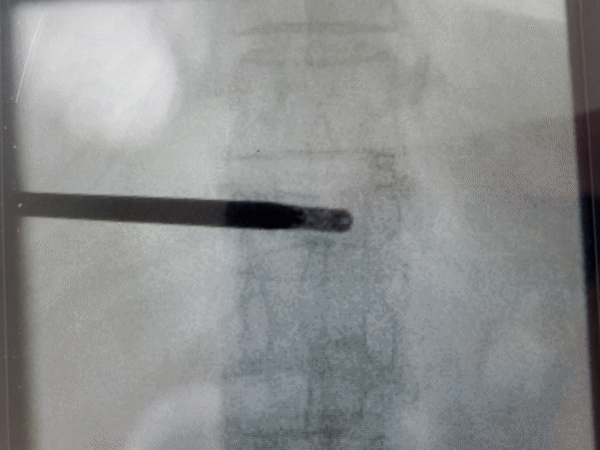 ezgif-7-9555bd6cd49c.gif