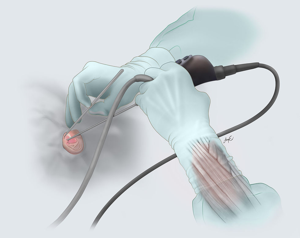 Gloved hands performing endoscopic surgery using a tool, with a focus on precision. The background is a soft gradient of pale colors.