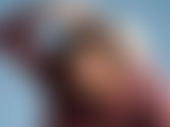 Can Hair Grow Back Without PRP or Hair Transplant? What Are Your Options?