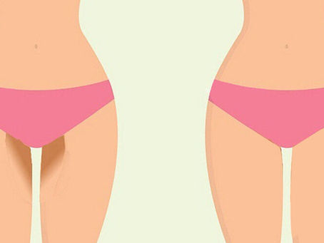 Why Intimate Pigmentation Comes Back (And How to Prevent It)