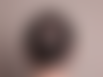 How to Improve PRP Results in Your Clinic: A Practical Guide for Better Outcomes