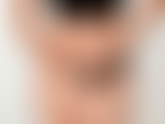 Intimate Area Pigmentation Treatment in India: A Complete Guide