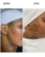 Skin Transormation