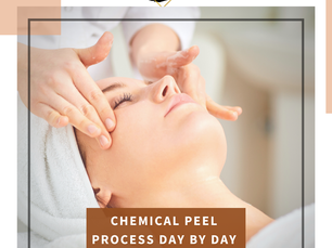Chemical Peel Process Day by Day- Take Knowledge