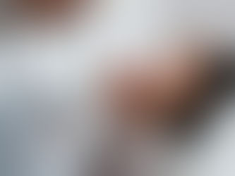 How Long Does Kybella Last?