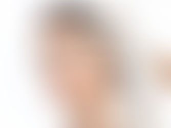 How Often Should You Get Botox?