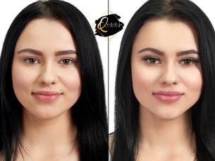 How Long Do Lip Injections Last? – Queen Aesthetics