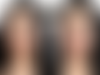 How Long Do Lip Injections Last? – Queen Aesthetics