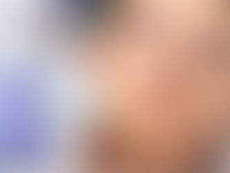 美容新領域:HIFU(二)