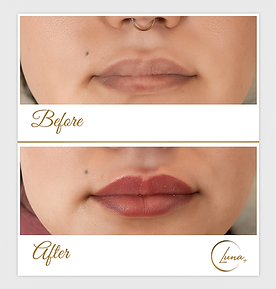 luna's medical aesthetic | botox